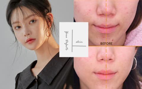 韓國小編親測！黑肉底,雀斑,瑕疵女孩也能擁有無暇白皙肌？韓國超夯的4款美白精華測評