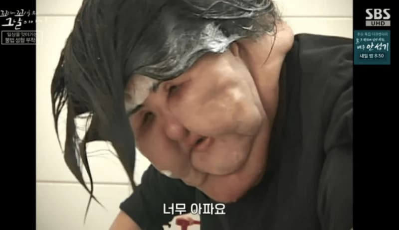 圖片來源：SBS